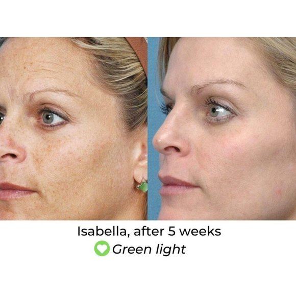 NIB Predire Paris 8 Element Treatment Led Mask - Picture 4 of 15